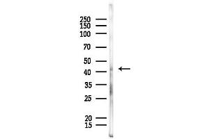 anti-Adhesion Molecule, Interacts with CXADR Antigen 1 (AMICA1) (C-Term) antibody