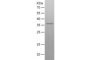 Western Blotting (WB) image for Necdin-Like 2 (NDNL2) (AA 1-304) protein (His tag) (ABIN7283319) (Necdin-Like 2 Protein (NDNL2) (AA 1-304) (His tag))