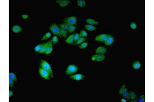 Immunofluorescent analysis of HepG2 cells using ABIN7161035 at dilution of 1:100 and Alexa Fluor 488-congugated AffiniPure Goat Anti-Rabbit IgG(H+L) (NANOS2 antibody  (AA 1-138))