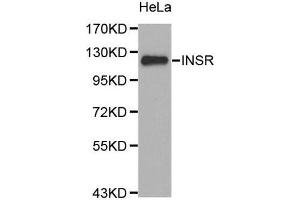 Western Blotting (WB) image for anti-Insulin Receptor (INSR) (N-Term) antibody (ABIN1513096) (Insulin Receptor antibody  (N-Term))