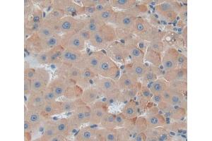 Figure. (PKC delta antibody  (AA 330-672))