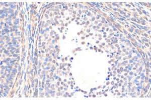 Immunohistochemistry of paraffin-embedded Rat ovary using Smad5 Polyclonal Antibody at dilution of 1:200 (40x lens). (SMAD5 antibody)