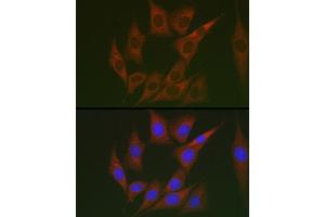 Immunofluorescence analysis of NIH/3T3 cells using Lumican (LUM) Rabbit pAb (ABIN6128190, ABIN6143388, ABIN6143389 and ABIN6220988) at dilution of 1:100 (40x lens). (LUM antibody  (AA 19-338))