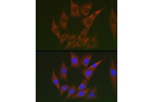 Immunofluorescence analysis of NIH/3T3 cells using Lumican (LUM) Rabbit pAb (ABIN6128190, ABIN6143388, ABIN6143389 and ABIN6220988) at dilution of 1:100 (40x lens). (LUM antibody  (AA 19-338))