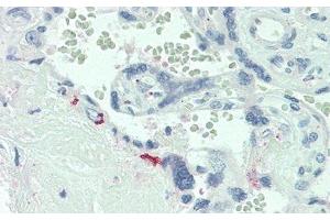 Detection of IL6R in Human Placenta Tissue using Polyclonal Antibody to Interleukin 6 Receptor (IL6R) (IL-6 Receptor antibody  (AA 205-347))