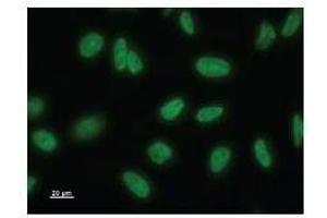 Immunostaining analysis in HeLa cells. (NAA38 antibody)