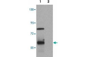 Western blot analysis of TSN in rat lung tissue lysate with TSN polyclonal antibody  at (1) 0. (Translin antibody  (C-Term))
