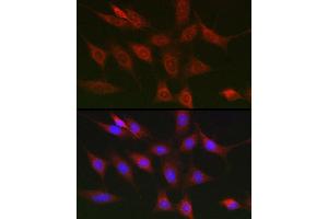 Immunofluorescence analysis of NIH/3T3 cells using RIPK1/RIP Rabbit pAb (ABIN6132596, ABIN6146959, ABIN6146960 and ABIN6223282) at dilution of 1:150 (40x lens). (RIPK1 antibody  (AA 170-440))