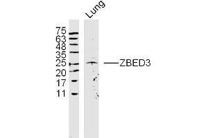 Rat lung lysates probed with ZBED3 Polyclonal Antibody, Unconjugated  at 1:300 dilution and 4˚C overnight incubation. (ZBED3 antibody  (AA 51-150))