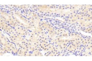 Immunohistochemistry (IHC) image for anti-Glutamate Receptor, Metabotropic 1 (GRM1) (AA 165-592) antibody (ABIN7441226)