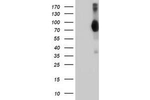 HEK293T cells were transfected with the pCMV6-ENTRY control (Left lane) or pCMV6-ENTRY VCAM1 (Right lane) cDNA for 48 hrs and lysed. (VCAM1 antibody)