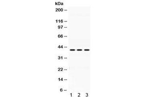 Western blot testing of 1) rat lung, 2) mouse liver and 3) human HepG2 lysate with Alcohol dehydrogenase antibody at 0. (ADH1A antibody)