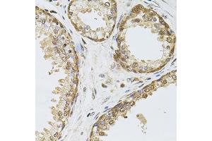 Immunohistochemistry of paraffin-embedded human prostate using POP4 antibody (ABIN5972510) at dilution of 1/100 (40x lens).