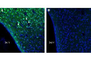 Expression of UCP2 in mouse hypothalamus.
