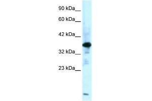Human Muscle; WB Suggested Anti-ZFPL1 Antibody Titration: 0. (ZFPL1 antibody  (Middle Region))