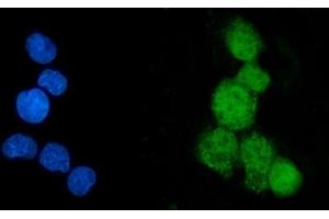 IF analysis of EEF2K using anti-EEF2K antibody (ABIN7600209). (EEF2K antibody  (AA 162-719))