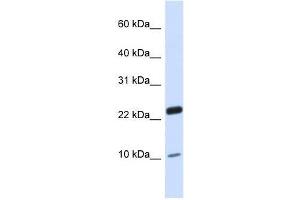 TAF13 antibody used at 0. (TAF13 antibody  (N-Term))