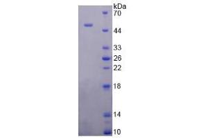 Image no. 1 for Surfactant Protein B (SFTPB) (AA 201-381) protein (His tag,GST tag) (ABIN4988781)