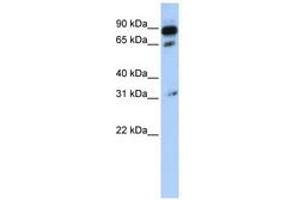 Image no. 1 for anti-ATP-Binding Cassette, Sub-Family D (Ald), Member 4 (ABCD4) (AA 108-157) antibody (ABIN6740835) (ABCD4 antibody  (AA 108-157))