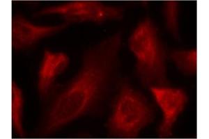 Image no. 2 for anti-Tumor Protein P53 (TP53) (pSer33) antibody (ABIN319216) (p53 antibody  (pSer33))