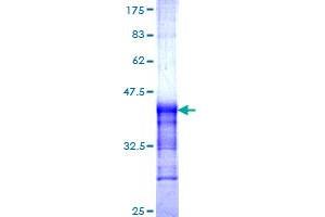 CDH6 Protein (AA 513-612) (GST tag)