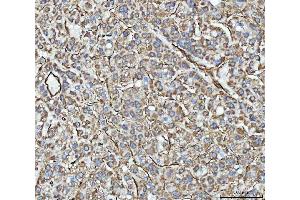 IHC analysis of PTRF/CAVIN1 using anti-PTRF/CAVIN1 antibody (ABIN7601817).