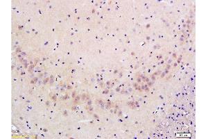 Formalin-fixed and paraffin embedded: rat brain tissue labeled with Anti-FLIP/c FLIP Polyclonal Antibody , Unconjugated at 1:300 followed by conjugation to the secondary antibody and DAB staining