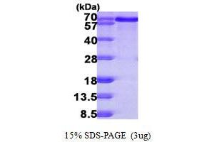 SDS-PAGE (SDS) image for B-Cell Linker (BLNK) (AA 1-456) protein (His tag) (ABIN667353)