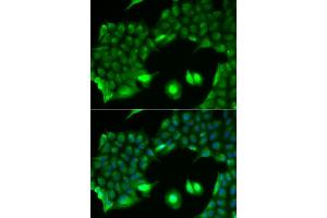 Immunofluorescence analysis of HeLa cells using SSX2 antibody. (SSX2 antibody)
