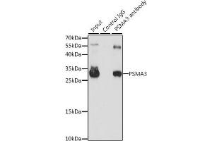 Immunoprecipitation analysis of 200 μg extracts of HL-60 cells, using 3 μg PSM antibody (ABIN3021834, ABIN3021835, ABIN3021836 and ABIN6216081).