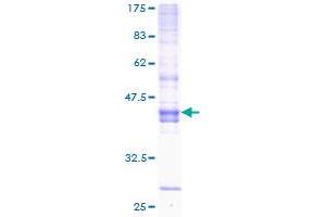 Image no. 1 for Inducible T-Cell Co-Stimulator (ICOS) (AA 1-168) protein (GST tag) (ABIN1307339) (ICOS Protein (AA 1-168) (GST tag))
