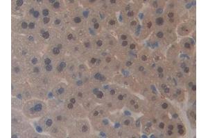 Detection of GAL4 in Mouse Liver Tissue using Polyclonal Antibody to Galectin 4 (GAL4) (GAL4 antibody  (AA 1-326))