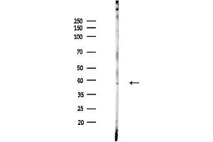 anti-Aminolevulinate Dehydratase (ALAD) antibody
