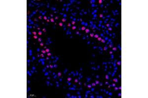 Immunofluorescence of paraffin embedded mouse testis using DNApoldelta3 (ABIN7075130) at dilution of 1:650 (400x lens) (POLD3 antibody)