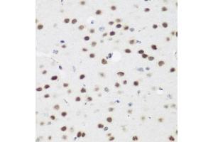Immunohistochemistry of paraffin-embedded mouse brain using  antibody (ABIN6131366, ABIN6136608, ABIN6136609 and ABIN6223268) at dilution of 1:200 (40x lens).