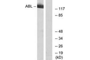 Western blot analysis of extracts from RAW264. (ABL1 antibody  (AA 406-455))
