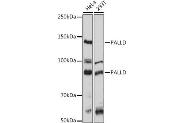 PALLD antibody  (AA 383-672)