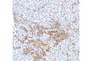 Immunohistochemistry (IHC) image for anti-Signal Transducer and Activator of Transcription 5A (STAT5A) (AA 744-794) antibody (ABIN7454017) (Recombinant STAT5A antibody  (AA 744-794))