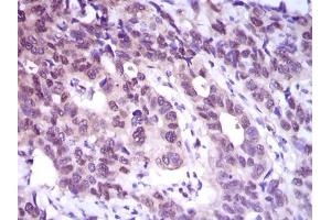 Immunohistochemistry (IHC) image for anti-ATP Citrate Lyase (ACLY) (AA 306-502) antibody (ABIN1098143)