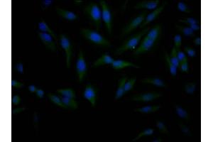 Immunofluorescence staining of Hela Cells with ABIN7127809 at 1:50, counter-stained with DAPI. (Recombinant SIRT1 antibody)