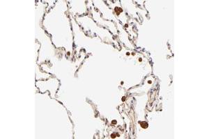 Immunohistochemical staining of human lung with TNFAIP3 polyclonal antibody  shows strong cytoplasmic positivity in macrophages.