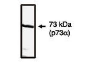 Image no. 1 for anti-Tumor Protein P73 (TP73) (C-Term) antibody (ABIN265052) (Tumor Protein p73 antibody  (C-Term))
