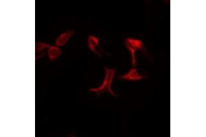 ABIN6274712 staining LOVO by IF/ICC. (AGPAT5 antibody  (Internal Region))