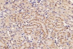 Immunohistochemistry analysis of paraffin-embedded mouse kidney using,ATP5G3 (ABIN7073143) at dilution of 1: 1400 (ATP5G3 antibody)