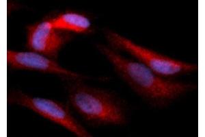 Immunofluorescence (IF) image for anti-Hexokinase 1 (HK1) (AA 1-917) antibody (PE) (ABIN5567562) (Hexokinase 1 antibody  (AA 1-917) (PE))