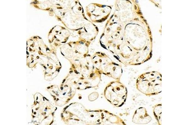 CCDC111 antibody