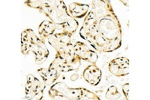 Immunohistochemistry of paraffin embedded human placenta using CCDC111 (ABIN7073534) at dilution of 1:700 (400x lens)