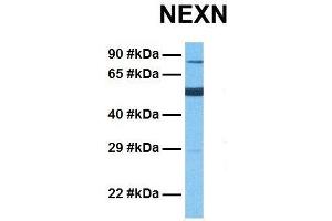 Host:  Rabbit  Target Name:  NEXN  Sample Tissue:  Human Fetal Lung  Antibody Dilution:  1. (NEXN antibody  (Middle Region))