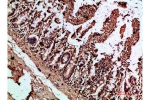 Immunohistochemical analysis of paraffin-embedded human-colon, antibody was diluted at 1:200 (IL17C antibody  (AA 81-130))