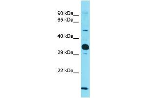 Host: Rabbit  Target Name: Nus1  Sample Tissue: Mouse Heart lysates  Antibody Dilution: 1. (Nogo B Receptor antibody  (Middle Region))